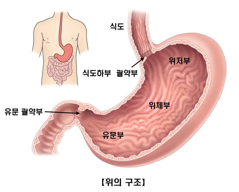 만성 위축성 위염 증상 위장 점막의 조직 병변이 나타나면 3